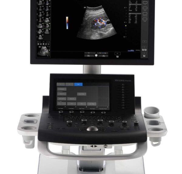 ultrasonograf Versana